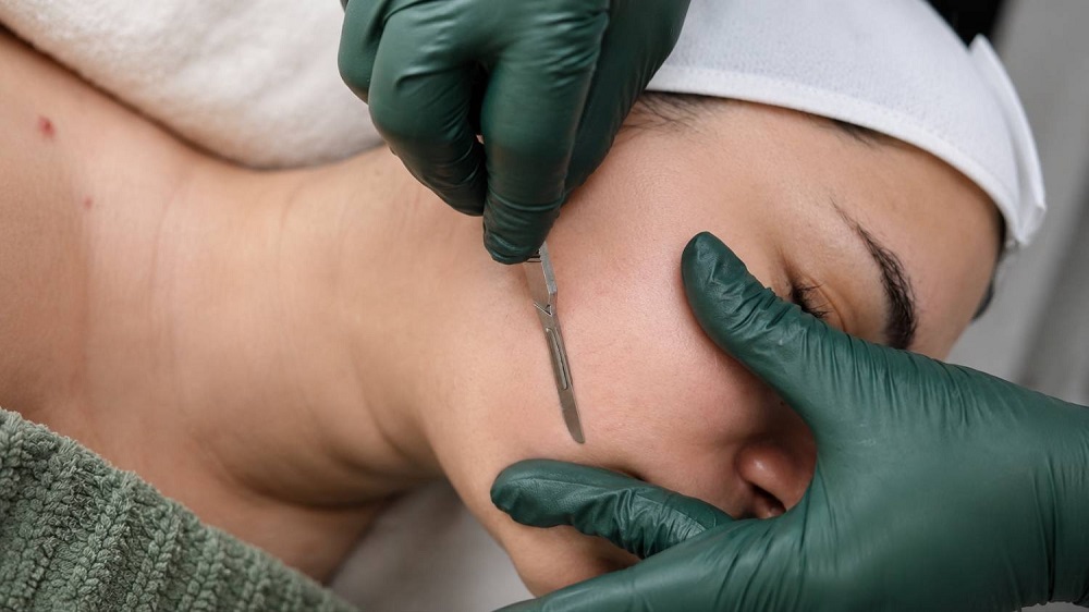 dermaplaning dead skin removal exfoliation plano texas service