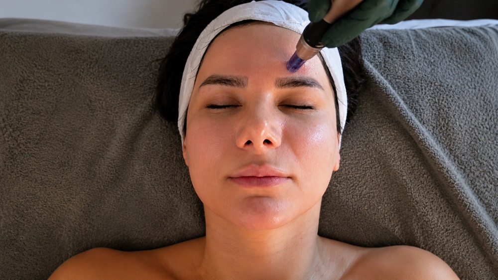 microneedling acne scar treatment skin repair plano texas service