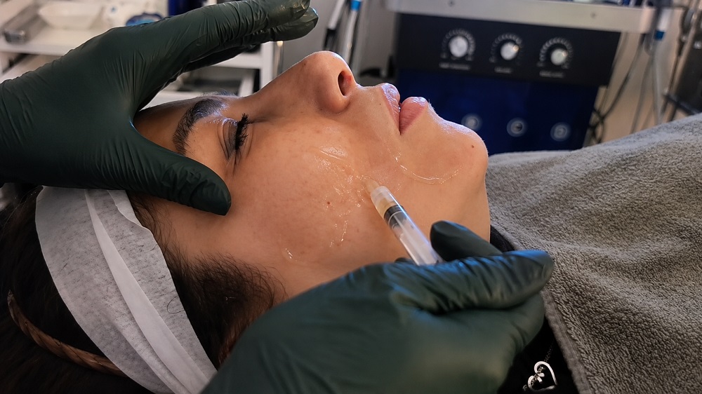 microneedling collagen production skin renewal plano texas service