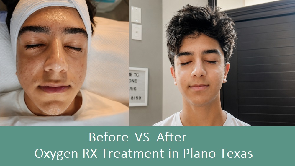 oxygen rx treatment before after skin transformation results plano texas service