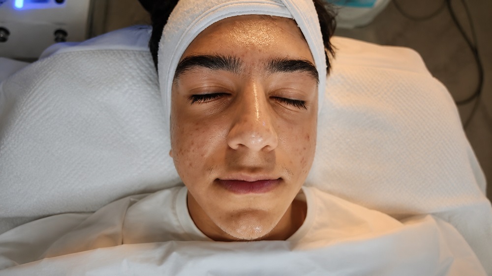 oxygen-rx-treatment-acne-control-skin-repair-plano-texas-service