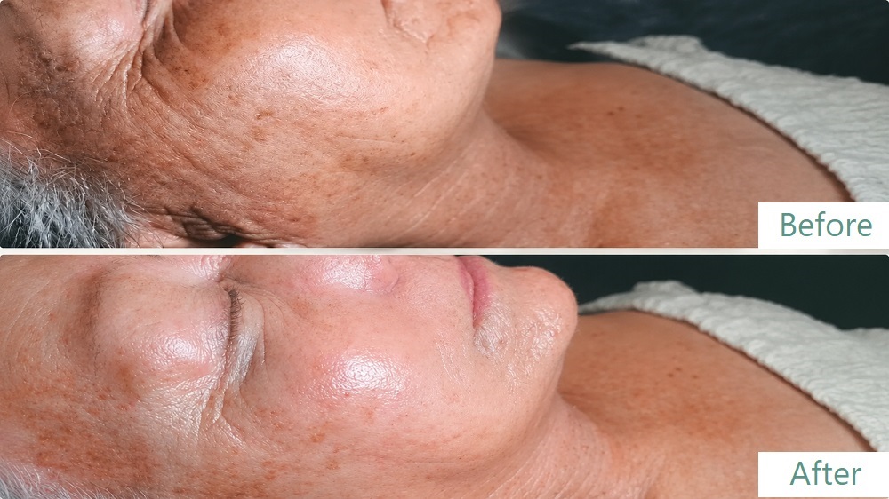 switch-facial-skin